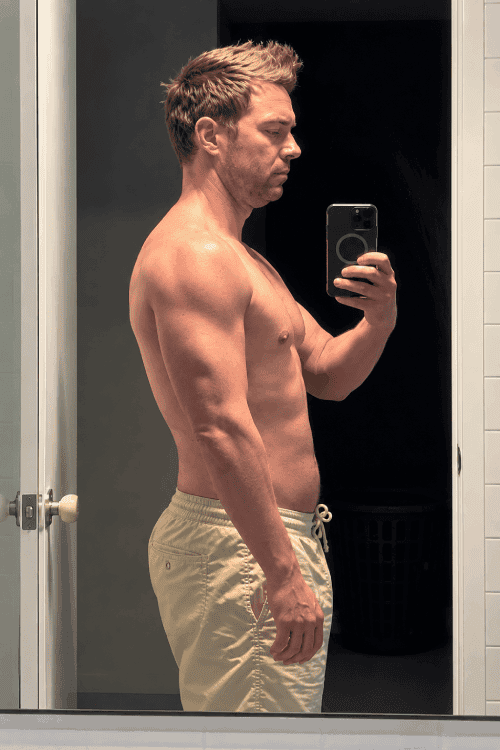 Before Retatrutide review side view